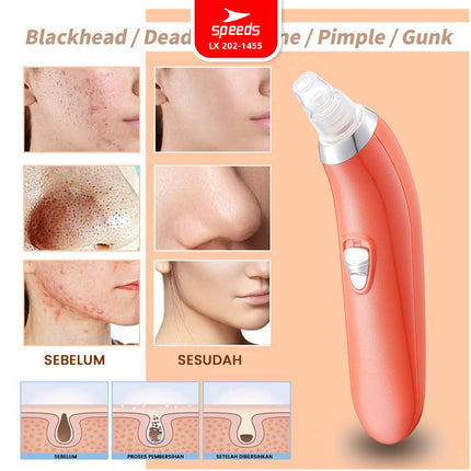 SPEEDS BlackHeads Remover Alat Penyedot Komedo Pembersih Jerawat Wajah Vacuum Cleaner Elektrik 202-1455