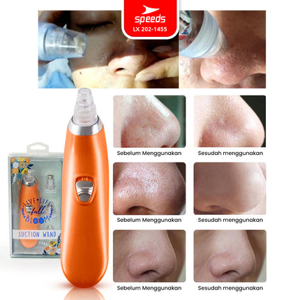 SPEEDS BlackHeads Remover Alat Penyedot Komedo Pembersih Jerawat Wajah Vacuum Cleaner Elektrik 202-1455