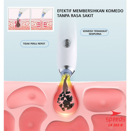 SPEEDS Alat Penyedot Komedo Blackhead Remover Pembersih Jerawat Wajah Elektrik Beauty Kecantikan 202-8