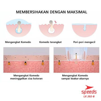SPEEDS Alat Penyedot Komedo Blackhead Remover Pembersih Jerawat Wajah Elektrik Beauty Kecantikan 202-8
